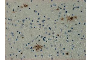 Immunohistochemistry (IHC) image for anti-Syndecan Binding Protein (Syntenin) (SDCBP) antibody (ABIN1742301) (SDCBP Antikörper)