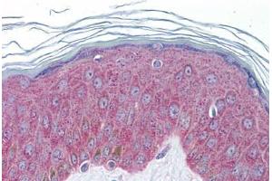 Human Skin: Formalin-Fixed, Paraffin-Embedded (FFPE) (IL-33 Antikörper  (AA 36-85))