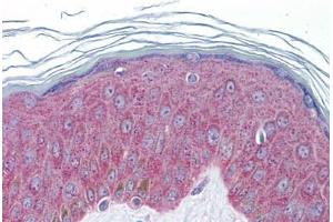 Human Skin: Formalin-Fixed, Paraffin-Embedded (FFPE) (IL-33 Antikörper  (AA 36-85))