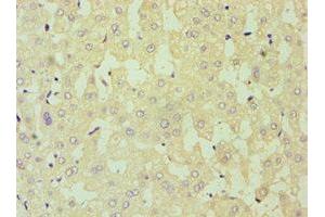Immunohistochemistry of paraffin-embedded human liver tissue using ABIN7149890 at dilution of 1:100