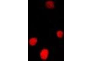 Immunofluorescent analysis of FGF14 staining in U2OS cells. (FGF14 Antikörper)