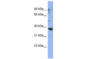 WB Suggested Anti-OR2L3 Antibody Titration: 0. (OR2L3 Antikörper  (C-Term))