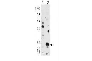 Western blot analysis of PIM1 (arrow) using PIM1 Antibody (ABIN392441 and ABIN2842039).