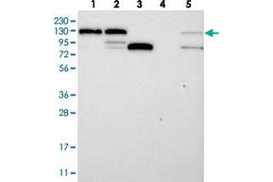 Western blot analysis of Lane 1: RT-4, Lane 2: U-251 MG, Lane 3: Human Plasma, Lane 4: Liver, Lane 5: Tonsil with DDX46 polyclonal antibody . (DDX46 Antikörper)
