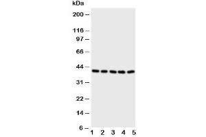 Western blot testing of BCAT2 antibody and Lane 1:  A431;  2: SW620;  3: SMMC-7721;  4: Jurkat;  5: CEM cell lysate (BCAT2 Antikörper  (C-Term))