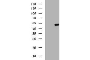 Western Blotting (WB) image for anti-Adipocyte Plasma Membrane Associated Protein (APMAP) antibody (ABIN1496662) (APMAP Antikörper)