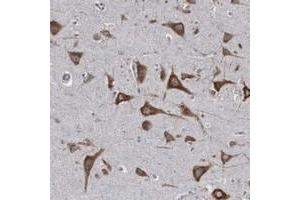 Immunohistochemical staining of human cerebral cortex with CTAGE5 polyclonal antibody  shows strong cytoplasmic positivity in neuronal cells. (MIA2 Antikörper  (AA 392-507))