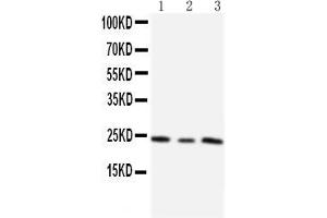 Anti-TIMP4 antibody, Western blotting Lane 1: HT1080 Cell Lysate Lane 2: HELA Cell Lysate Lane 3: SMMC Cell Lysate (TIMP4 Antikörper  (C-Term))