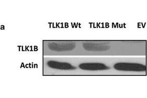 a Overexpression of Wt TLK1B and Mut TLK1B in stably transfected HEK293 cells. (TLK1 Antikörper)