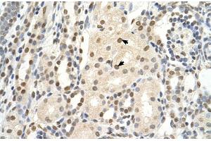 Rabbit Anti-PUF60 Antibody  Paraffin Embedded Tissue: Human Kidney Cellular Data: Epithelial cells of renal tubule Antibody Concentration: 4. (PUF60 Antikörper  (C-Term))