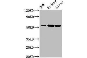 Western Blot Positive WB detected in: 293 whole cell lysate, Mouse kidney tissue, Mouse liver tissue All lanes: DBT antibody at 4. (DBT Antikörper  (AA 140-259))