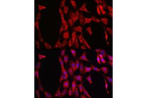Immunofluorescence analysis of NIH/3T3 cells using LDHA Rabbit mAb  at dilution of 1:100 (40x lens). (Lactate Dehydrogenase A Antikörper)