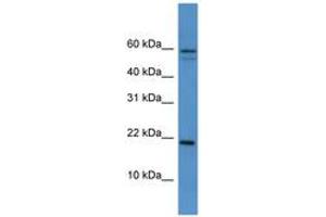 Image no. 1 for anti-Heat Shock 27kDa Protein Family, Member 7 (Cardiovascular) (HSPB7) (AA 51-100) antibody (ABIN6746091)