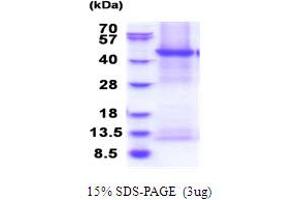SDS-PAGE (SDS) image for Ectonucleoside Triphosphate diphosphohydrolase 6 (ENTPD6) (AA 61-484) protein (His tag) (ABIN5853855)
