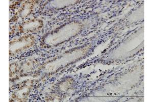 Immunoperoxidase of monoclonal antibody to YY1 on formalin-fixed paraffin-embedded human stomach. (YY1 Antikörper  (AA 221-320))