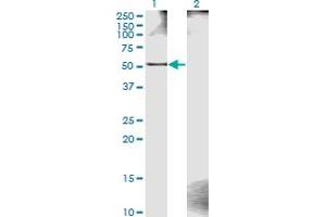 Western Blot analysis of ZWILCH expression in transfected 293T cell line by ZWILCH monoclonal antibody (M11), clone 1C10. (ZWILCH Antikörper  (AA 1-477))