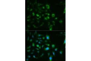 Immunofluorescence analysis of MCF7 cell using TLR8 antibody. (TLR8 Antikörper  (AA 849-1041))