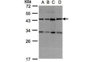 WB Image Sample(30 ug whole cell lysate) A:293T B:A431, C:HeLa S3, D:Raji , 12% SDS PAGE antibody diluted at 1:1000 (DNAJC17 Antikörper  (Center))