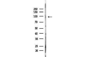 Western blot analysis of lysates from HepG2 cells(heat-shock,45 min treatment), using HCN2 Antibody at 1/1000 dilution.