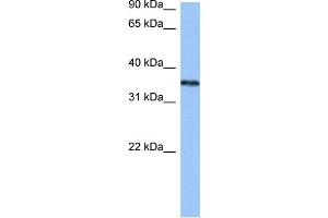 WB Suggested Anti-HNRNPA2B1 Antibody Titration:  0. (HNRNPA2B1 Antikörper  (N-Term))