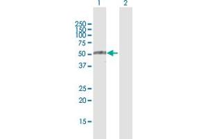 Western Blot analysis of TRIM35 expression in transfected 293T cell line by TRIM35 MaxPab polyclonal antibody. (TRIM35 Antikörper  (AA 1-493))