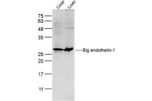 Lane 1: mouse liver lysates Lane 2: rat liver lysates probed with Preproendothelin 1 Polyclonal Antibody, Unconjugated  at 1:300 dilution and 4˚C overnight incubation. (Prepro-Endothelin-1 (AA 16-110) Antikörper)