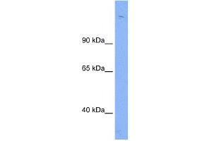 WB Suggested Anti-Sin3b Antibody Titration:  0. (SIN3B Antikörper  (N-Term))