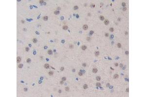 Used in DAB staining on fromalin fixed paraffin- embedded brain tissue (TOPBP1 Antikörper  (AA 1-246))