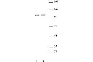 STAT2 antibody (pAb) tested by Immunoprecipitation. (STAT2 Antikörper  (C-Term))
