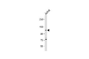 Anti-PKN1 Antibody (C-Term) at 1:2000 dilution + Jurkat whole cell lysate Lysates/proteins at 20 μg per lane. (PKN1 Antikörper  (AA 836-870))