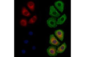 ABIN6261327 and ABIN6278854 staining Hela cells by IF/ICC.