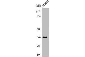 Western Blot analysis of COLO205 cells using Olfactory receptor 5P3 Polyclonal Antibody (OR5P3 Antikörper  (Internal Region))