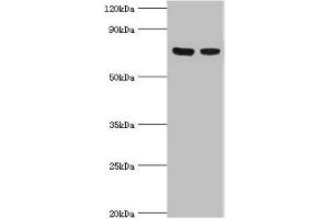 Western blot All lanes: TCTN2 antibody at 10 μg/mL Lane 1: Jurkat whole cell lysate Lane 2: A549 whole cell lysate Secondary Goat polyclonal to rabbit IgG at 1/10000 dilution Predicted band size: 77 kDa Observed band size: 77 kDa (TCTN2 Antikörper  (AA 420-670))