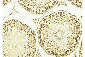 ABIN6269353 at 1/100 staining Mouse testis tissue by IHC-P.