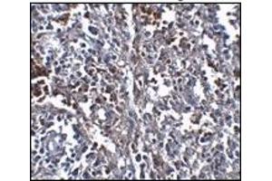 Immunohistochemistry (IHC) image for anti-ORAI Calcium Release-Activated Calcium Modulator 1 (ORAI1) (C-Term) antibody (ABIN492545) (ORAI1 Antikörper  (C-Term))