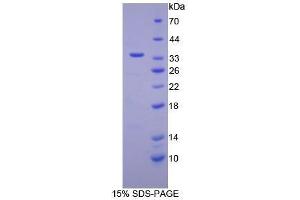 SDS-PAGE (SDS) image for Retinol Binding Protein 3, Interstitial (RBP3) (AA 19-320) protein (His tag) (ABIN1080642)