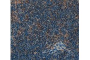 Immunohistochemistry (IHC) image for anti-Selectin L (SELL) (AA 101-343) antibody (ABIN1863134)