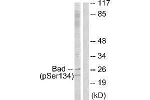 Immunohistochemistry analysis of paraffin-embedded human brain tissue using BAD (Phospho-Ser134) antibody. (BAD Antikörper  (pSer134))