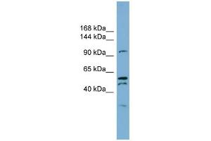 Anoctamin 6 antibody used at 1 ug/ml to detect target protein. (Anoctamin 6 Antikörper  (Middle Region))