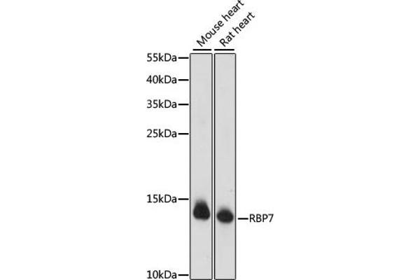 RBP7 Antikörper  (AA 1-134)