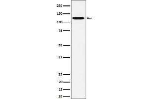 Western blot analysis of PKN2 expression in HeLa cell lysate.