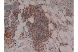 Immunohistochemistry (IHC) image for anti-Cytochrome P450, Family 27, Subfamily B, Polypeptide 1 (CYP27B1) (AA 256-508) antibody (ABIN7442201)