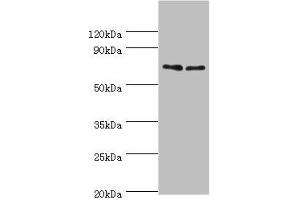 Western blot All lanes: TNFRSF21 antibody at 4 μg/mL Lane 1: K562 whole cell lysate Lane 2: Jurkat whole cell lysate Secondary Goat polyclonal to rabbit IgG at 1/10000 dilution Predicted band size: 72 kDa Observed band size: 72 kDa (TNFRSF21 Antikörper  (AA 371-655))