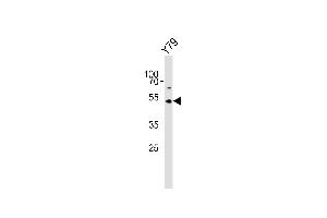 Western blot analysis of lysate from Y79 cell line, using ASMT Antibody (Center) (ABIN650987 and ABIN2840024). (ASMT Antikörper  (AA 212-241))