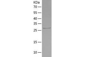 CUEDC2 Protein (AA 1-287) (His tag)