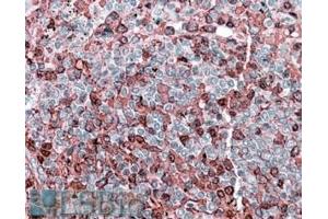ABIN571020 (3. (NFAT1 Antikörper  (Internal Region))