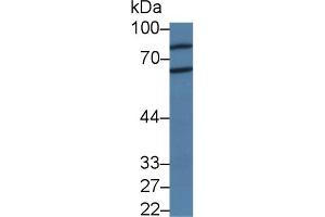 Western blot analysis of Rat Cerebrum lysate, using Human PADI2 Antibody (3 µg/ml) and HRP-conjugated Goat Anti-Rabbit antibody ( (PADI2 Antikörper  (Met1, Thr300))