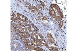 IHC analysis of MFF using anti-MFF antibody (ABIN7599292).