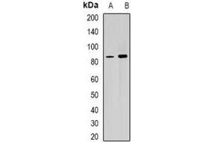Western blot analysis of RPGR expression in Y79 (A), mouse heart (B) whole cell lysates.