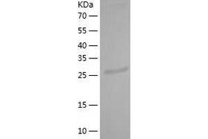 Western Blotting (WB) image for Zinc Finger Protein 28 (ZFP28) (AA 21-278) protein (His tag) (ABIN7287985) (ZFP28 Protein (AA 21-278) (His tag))